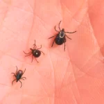 tick-borne-allergies-to-red-meat-only-ever-result-in-gastrointestinal-symptoms:-gunshots