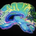 brain-scanning-technology-is-now-ready-for-use-in-clinical-psychedelic-experiments-thanks-to-a-new-“all-london-partnership.”