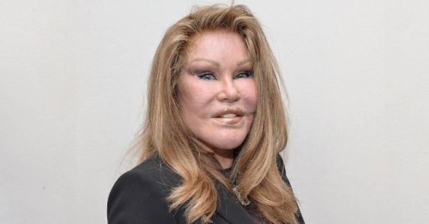 «Catwoman then and now!» This is what Jocelyn Wildenstein looked like before her plastic surgery disaster