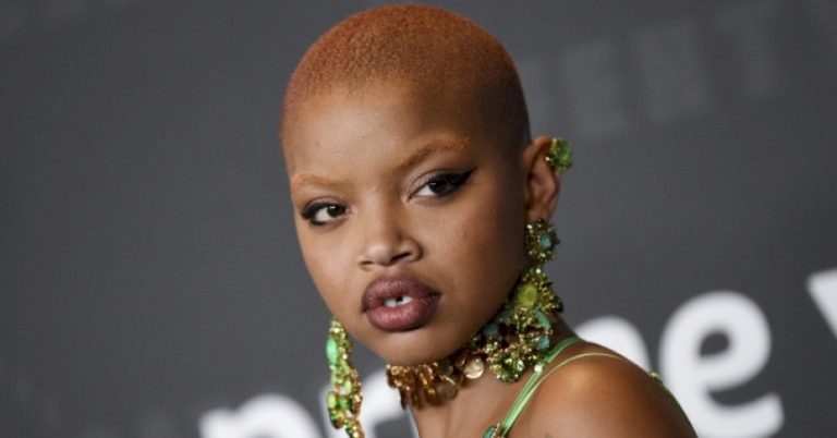 «Beauty is different!» The incredible journey of Slick Woods from homelessness to modeling