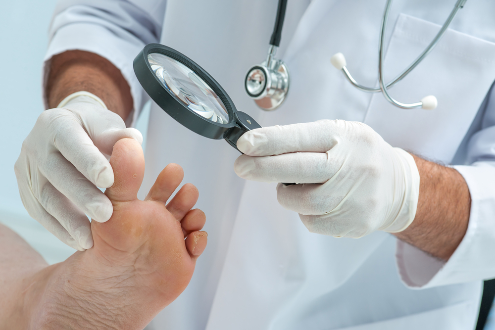 Doctor dermatologist examines the foot on the presence of athlete's foot