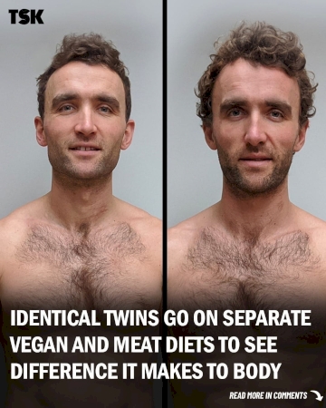 Identical Twins Trailed a Vegan Diet Vs. Omnivorous Diet