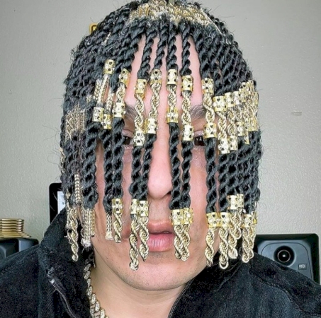 A rapper is in big trouble after getting gold chains surgically placed in his head to look like hair. This risky procedure could lead to serious health problems.